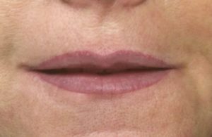 ideal empfundene Lippenform